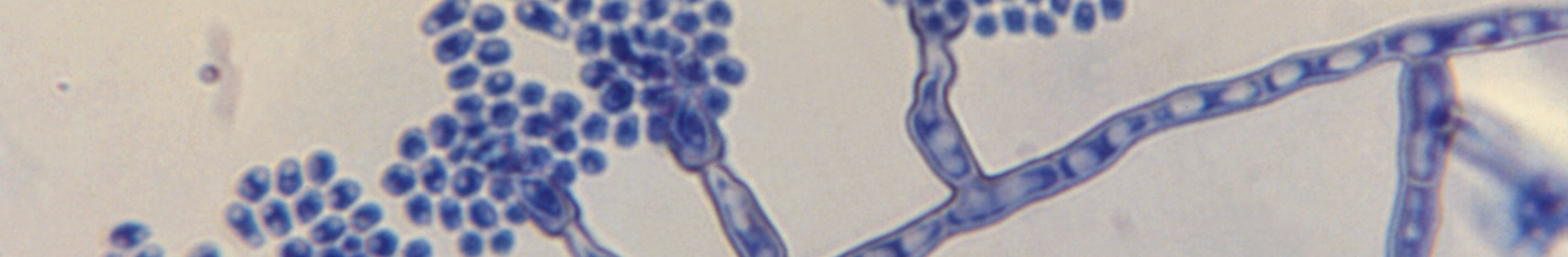 Phialophora verrucosa Georg 1964