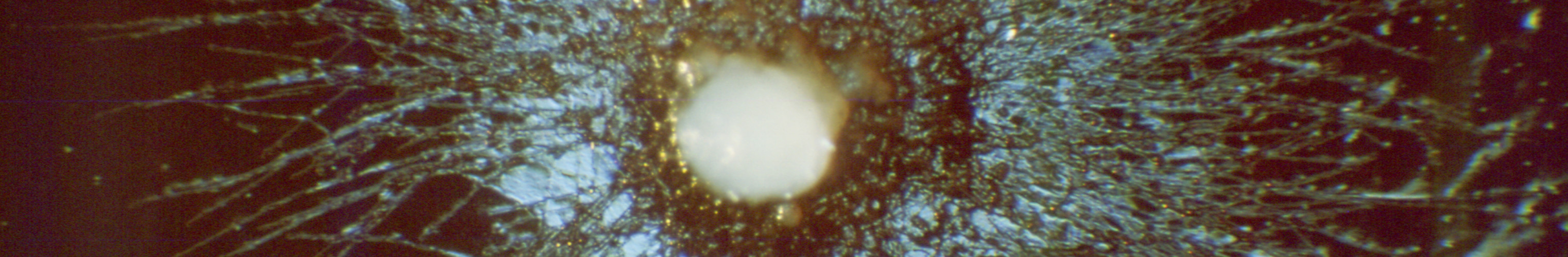 Candida albicans on Blood Agar Hardin CDC 1965